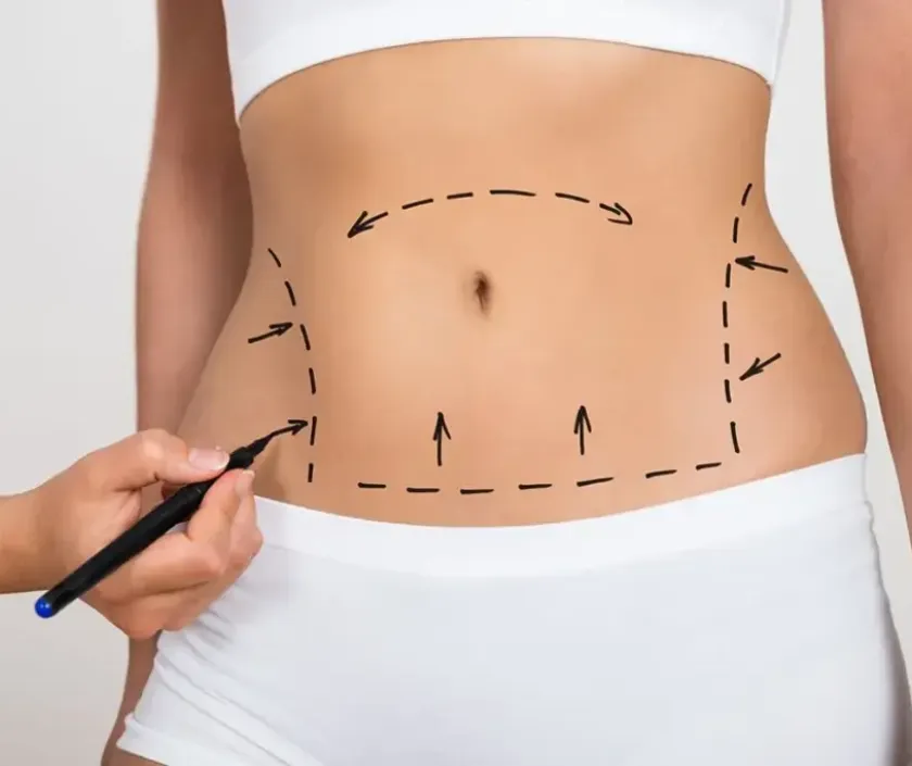 Torso & Waist at Elegance Transgender Clinic, Surat