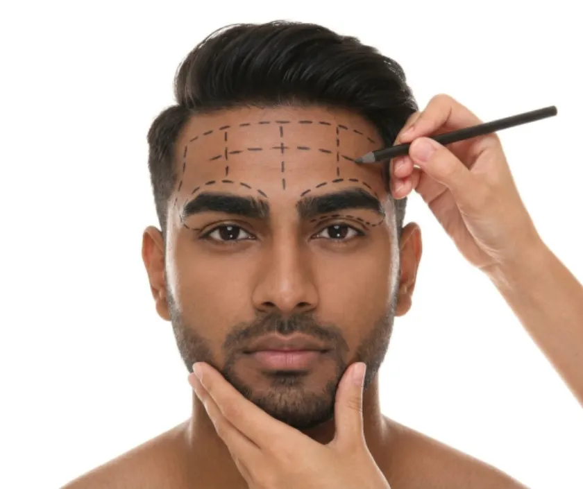 Forehead & Brow (Masculinization) facial masculinization procedures at Elegance Transgender Clinic, Surat