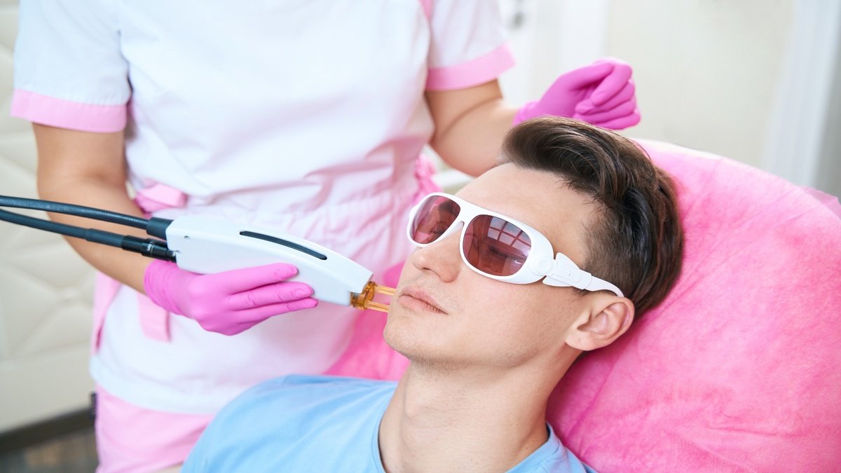 Facial Laser Hair Removal for Transgender Patients in India: A Complete Guide